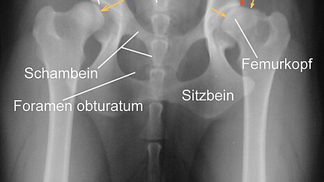 Hüftdysplasie beim Hund
